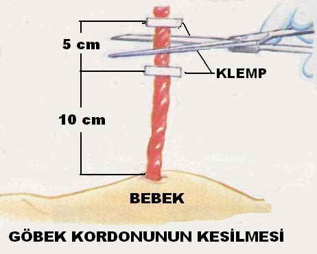 Akıllı Saat Kordonu